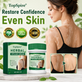 TopSpire® Herbal Vitiligo Cream