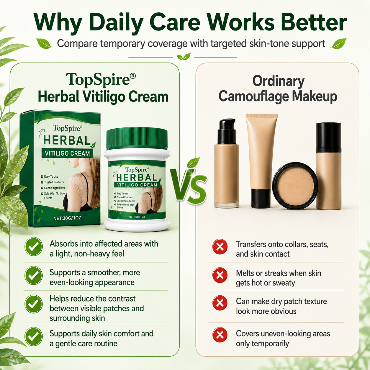 TopSpire® Herbal Vitiligo Cream